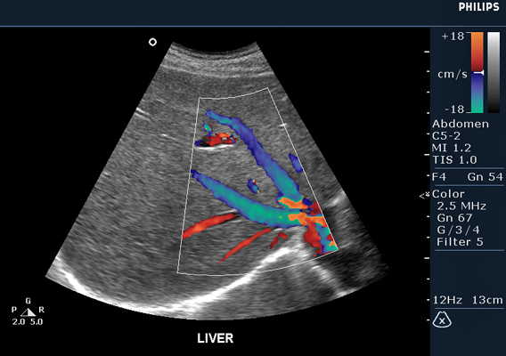 УЗИ органов брюшной полости.jpg